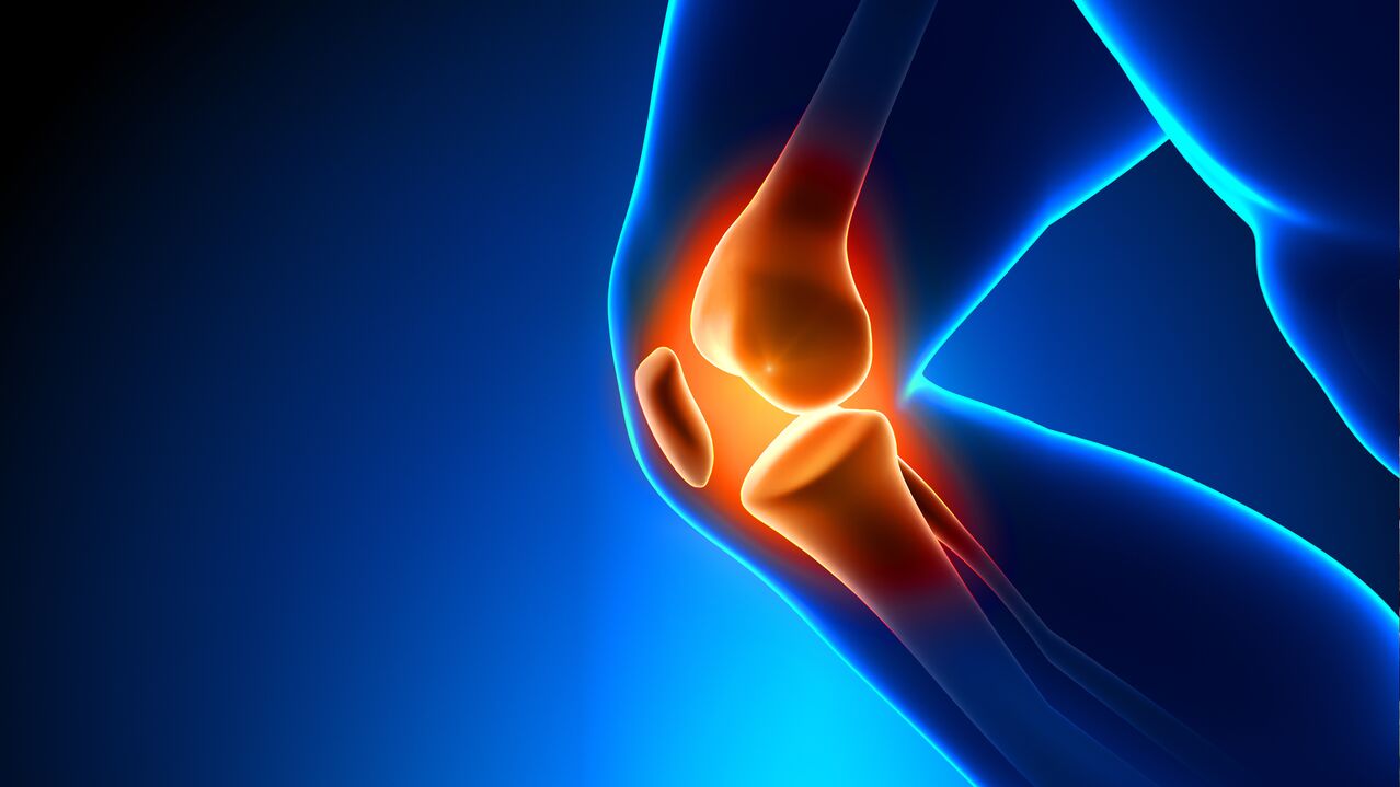Arthrose der Gelenke
